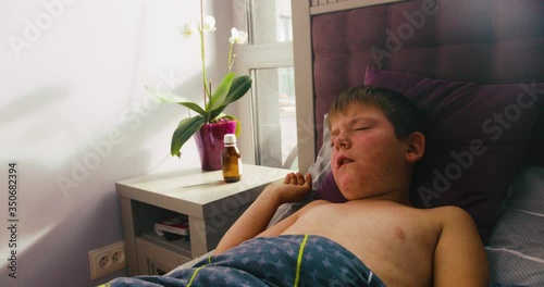 COVID-19. Child with viral infection measles lies in the bed and coughs heavy photo