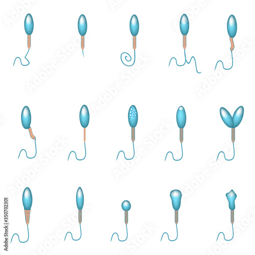 Pathological forms of sperm in the ejaculate. Male infertility Oligospermia. Spermogram. Sperm pathology types. Sperm defects. Infographics. Vector illustration on isolated background.