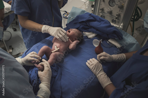 First moment of a newborn, labor in a hospital. After birth.