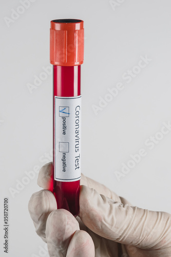 Vacuum tube with a blood sample with a positive result for Covid-19 infection in the hand with a medical glove on a white background