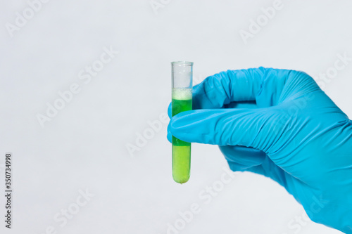 Doctor hands in disposable gloves holding virus sample