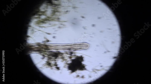 Naididae movement at 100x magnification