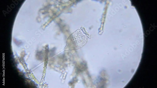 Stentor creating water current with diatom stuck at 100x magnification