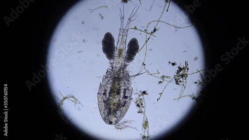 Deceased Copepod with eggs