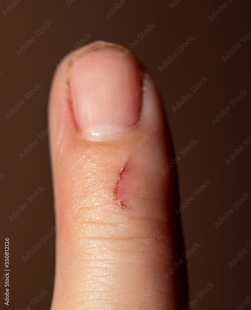 finger scratch on a dark background finger scratch on a dark background