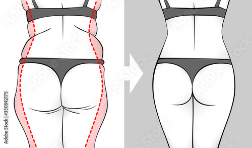 The body of a woman before and after losing weight. Back, butt and hips. Red outline showing overweight.