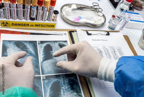 Doctor and nurse detects diagnosis in a child's lung affected by Kawasaki disease with several blood samples in a hospital, conceptual image photo