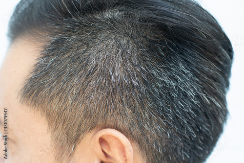 Close up gray hair on the head of Asia young male