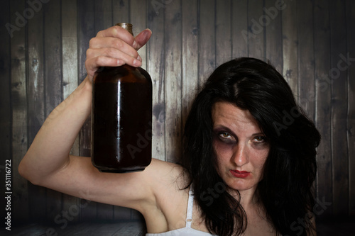 A young woman with a bruised eye holds a bottle of alcohol in her hand.