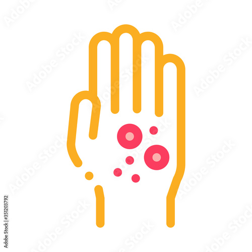 dermatitis rash on hands icon vector. dermatitis rash on hands sign. color symbol illustration