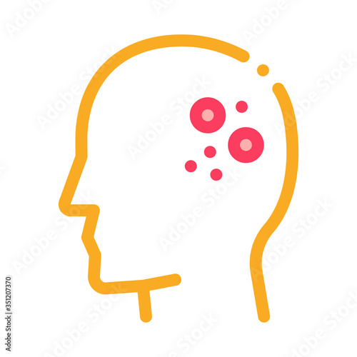 main problem of dermatitis icon vector. main problem of dermatitis sign. color symbol illustration