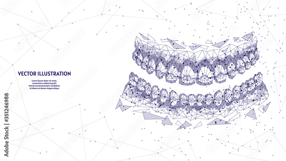 Dental jaw with braces on teeth close-up. Correct bite correction of teeth. Orthodontics, stomotology, innovative medical technology. 3d low poly wireframe vector illustration.