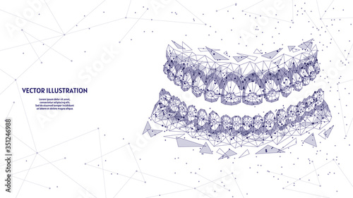 Dental jaw with braces on teeth close-up. Correct bite correction of teeth. Orthodontics, stomotology, innovative medical technology. 3d low poly wireframe vector illustration. photo