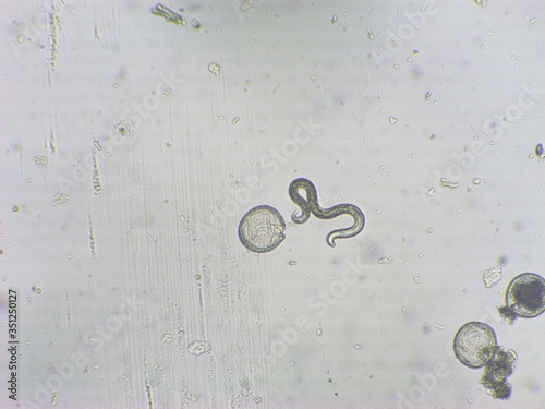 Toxocara canis second stage larvae hatch from eggs