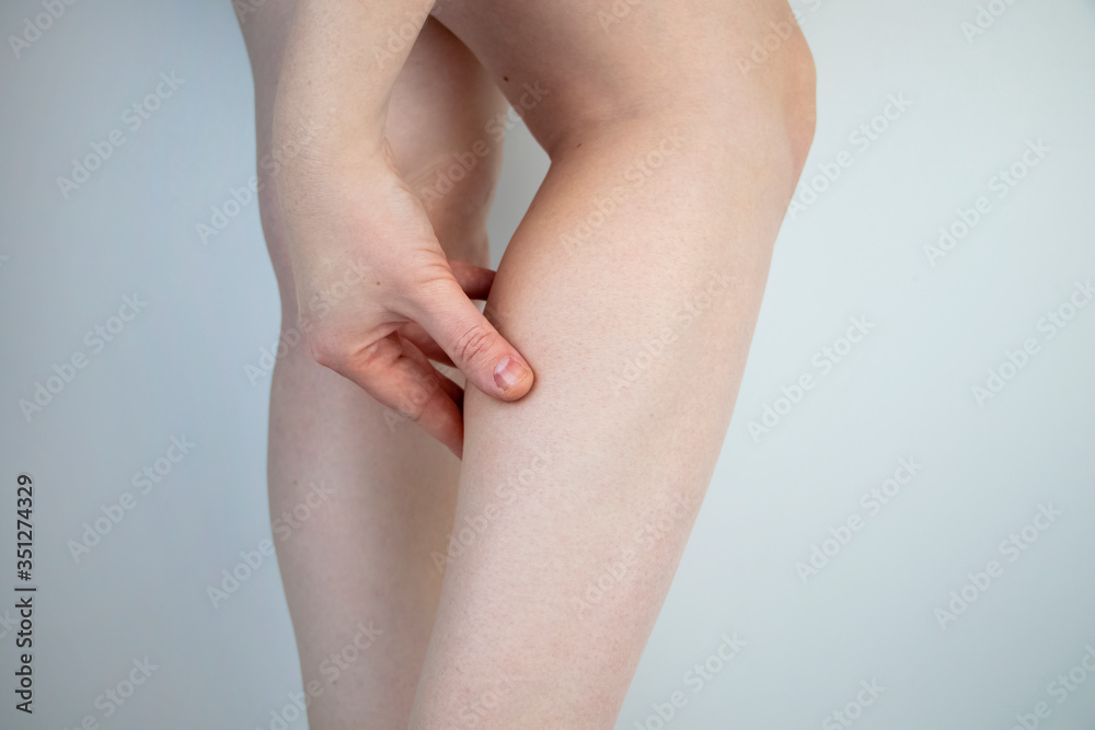 A woman suffers from pain in the calves. Stretching the calf muscle, varicose veins, leg cramps, or myositis. Orthopedic doctor examines patient A woman suffers from pain in the calves. Stretching the calf muscle, varicose veins, leg cramps, or myositis. Orthopedic doctor examines patient