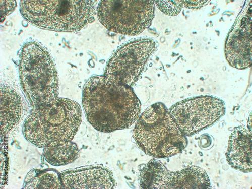 Protoscolices Echinococcus multilocularis microscopic photo of being released from a larvacyst. Is a cyclophyllid tapeworm, produces the fatal disease alveolar echinococcosis in mammals