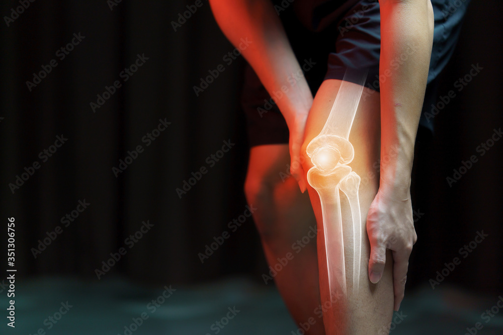 © marchsirawit - Medical concept, man suffering  with knee painful - skeleton x-ray,