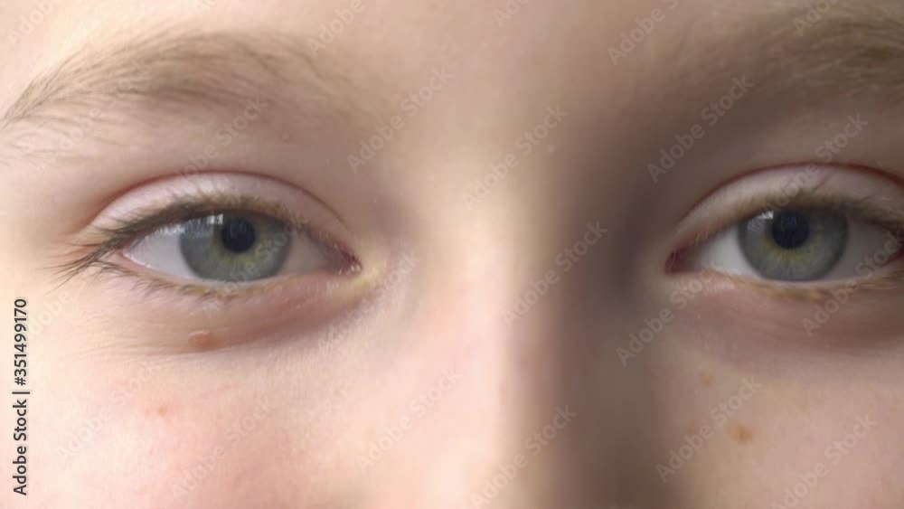 Close up gray eyes of smiling young caucasian girl looking to camera. Sight young teenager girl to camera. Human vision organs. Anatomy human face and head Close up gray eyes of smiling young caucasian girl looking to camera. Sight young teenager girl to camera. Human vision organs. Anatomy human face and head