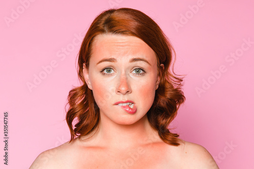 Woman with sunburnt skin biting her lips
