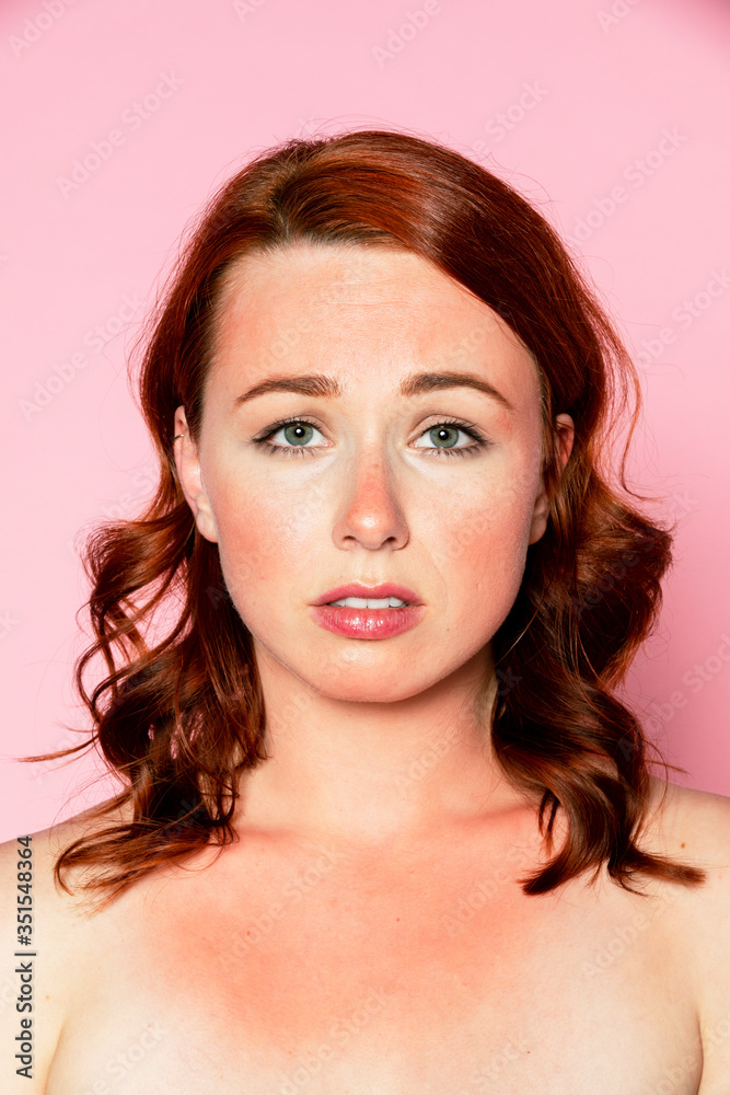 Fototapeta premium Sad woman with sunburnt skin
