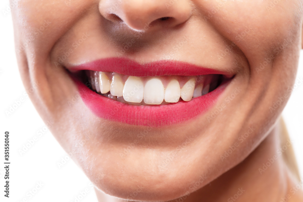 Close up of a smile with white teeth Close up of a smile with white teeth