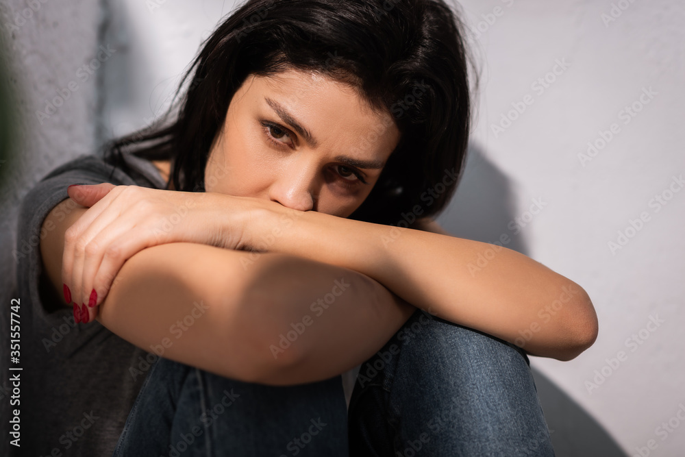 depressed woman with bruise on face, domestic violence concept depressed woman with bruise on face, domestic violence concept