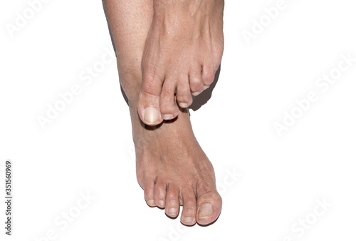 Feet of a caucasian adult woman on white background. © Toni