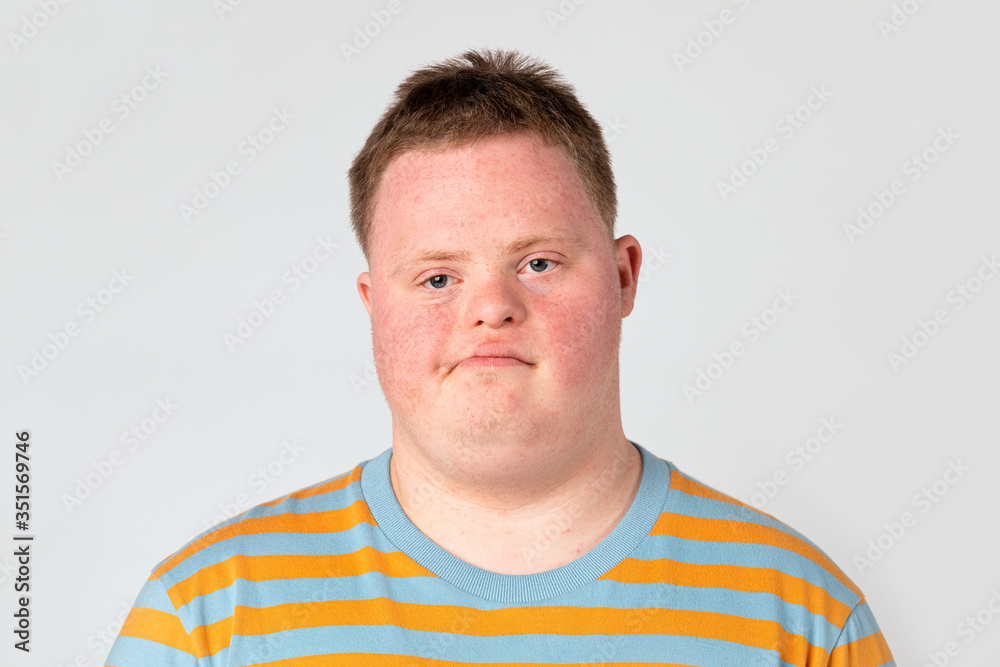 Fototapeta premium Sad boy with down syndome