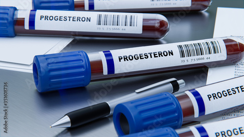 Progesteron Hormon Messung mit Bluttest im Labor photo