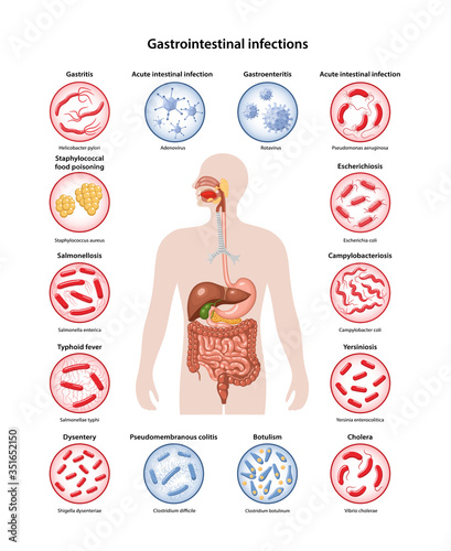 Page template with image of human body and bacteria and viruses that cause main gastrointestinal infections: Gastritis, Cholera, Dysentery, Salmonella, Gastroenteritis, colitis. Vector illustration