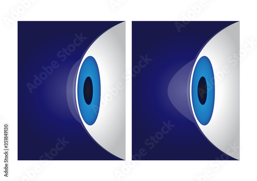 eye cornea and keratoconus vector / anatomy