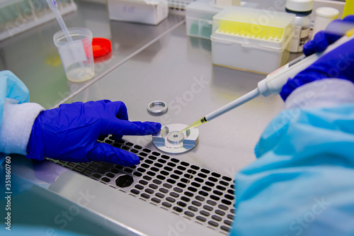 In vitro fertilization laboratory biotechnology sperm cells analysis 