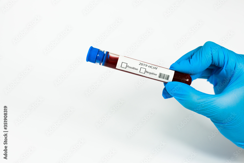 Obraz premium Hand holds a test tube containing a blood sample, test tube with blood for Covid-19 (coronavirus) analyzing. Laboratory testing patient’s blood. Blue nitrile glove.