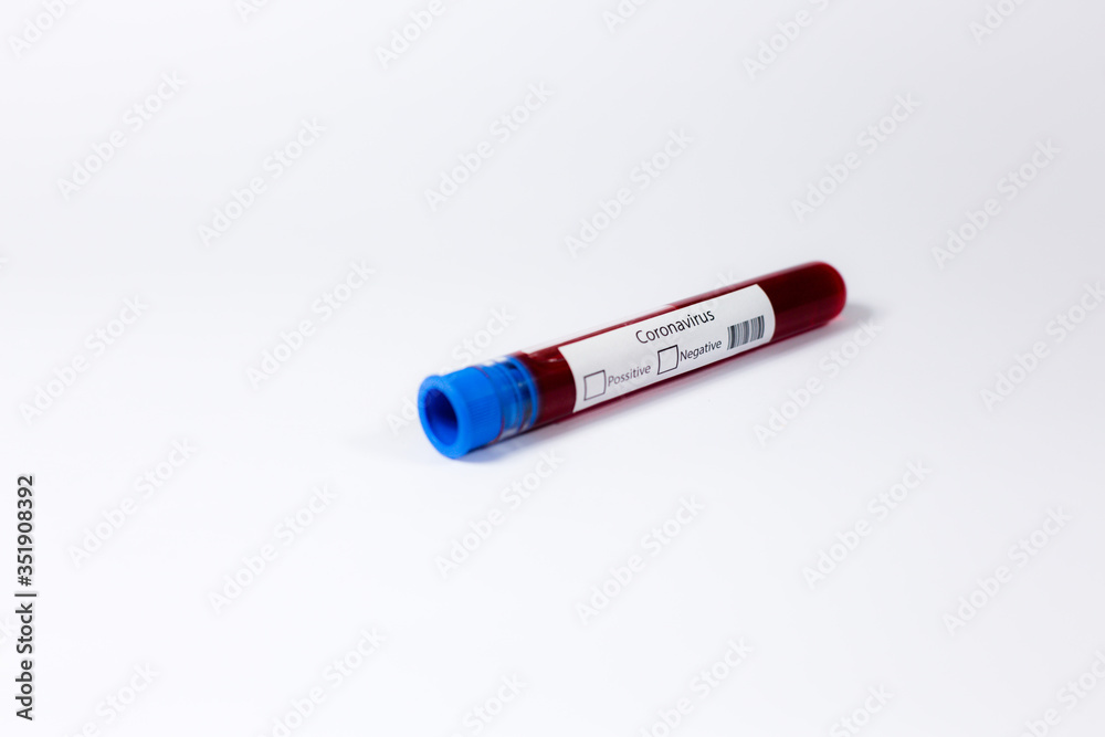 Blood test samples for the presence of a coronavirus (COVID-19) tube containing a blood sample to be tested for the coronavirus. Blood test samples for the presence of a coronavirus (COVID-19) tube containing a blood sample to be tested for the coronavirus.