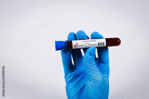 Hand holds a test tube containing a blood positive sample, test tube with blood for Covid-19 (coronavirus) analyzing. Laboratory testing patient’s blood. Blue nitrile glove. photo