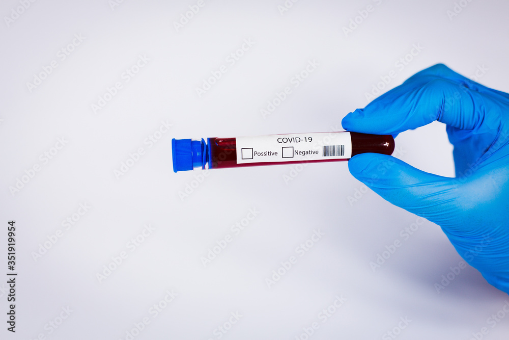 Obraz premium Hand holds a test tube containing a blood sample, test tube with blood for Covid-19 (coronavirus) analyzing. Laboratory testing patient’s blood. Blue nitrile glove.