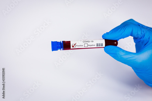 Hand holds a test tube containing a blood positive sample, test tube with blood for Covid-19 (coronavirus) analyzing. Laboratory testing patient’s blood. Blue nitrile glove. photo