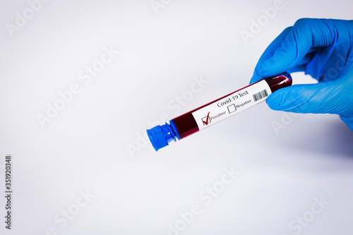 Hand holds a test tube containing a blood positive sample, test tube with blood for Covid-19 (coronavirus) analyzing. Laboratory testing patient’s blood. Blue nitrile glove. photo