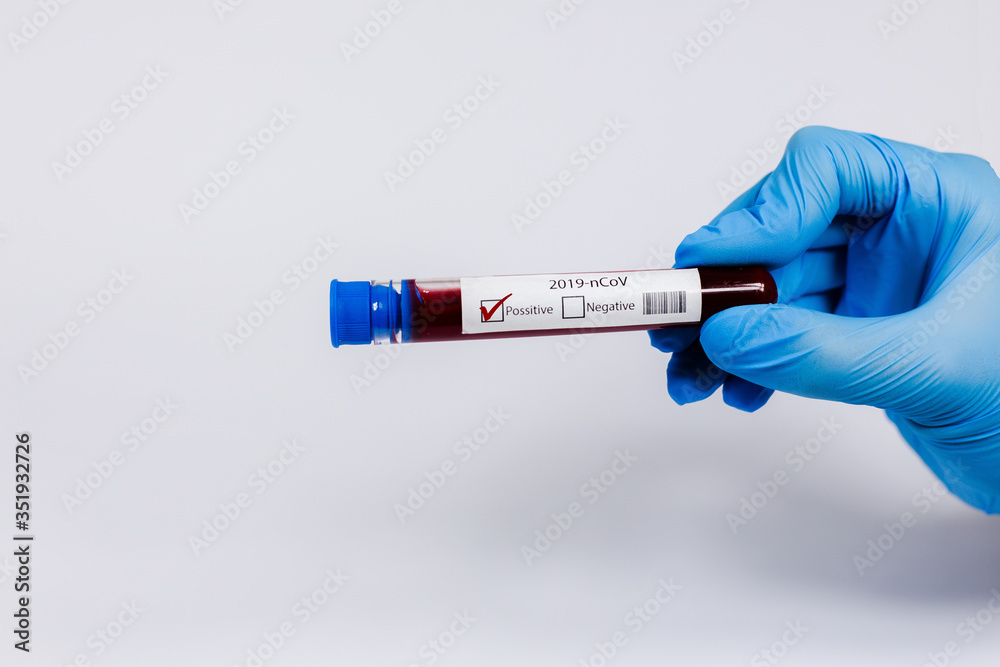 Naklejka premium Hand holds a test tube containing a blood positive sample, test tube with blood for Covid-19 (coronavirus) analyzing. Laboratory testing patient’s blood. Blue nitrile glove.