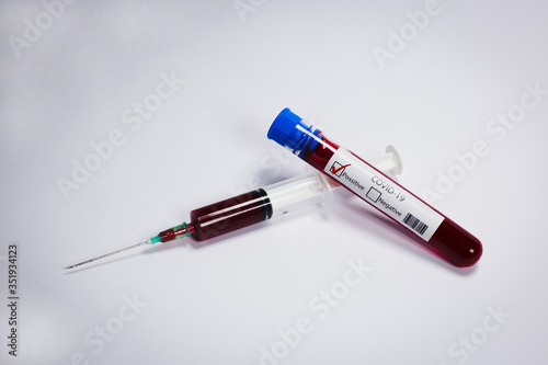 Test tube with blood sample Covid-19 (coronavirus). Laboratory blood test. syringe with blood. 
Covid-19 (coronavirus) positive test tube.
