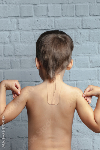 Child athlete with teips on his back. Treatment of spine, back problems, scoliosis.  photo