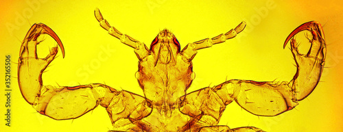 Human louse (Pediculus humanus Linnaeus, 1758) head and anterior legs (ventral view) - permanent microscope slide