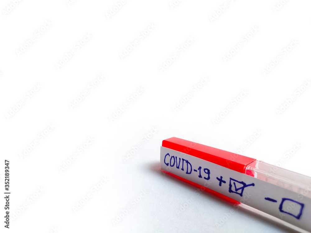 Obraz premium Corona virus testing sample bottle test tube, kept on White background.