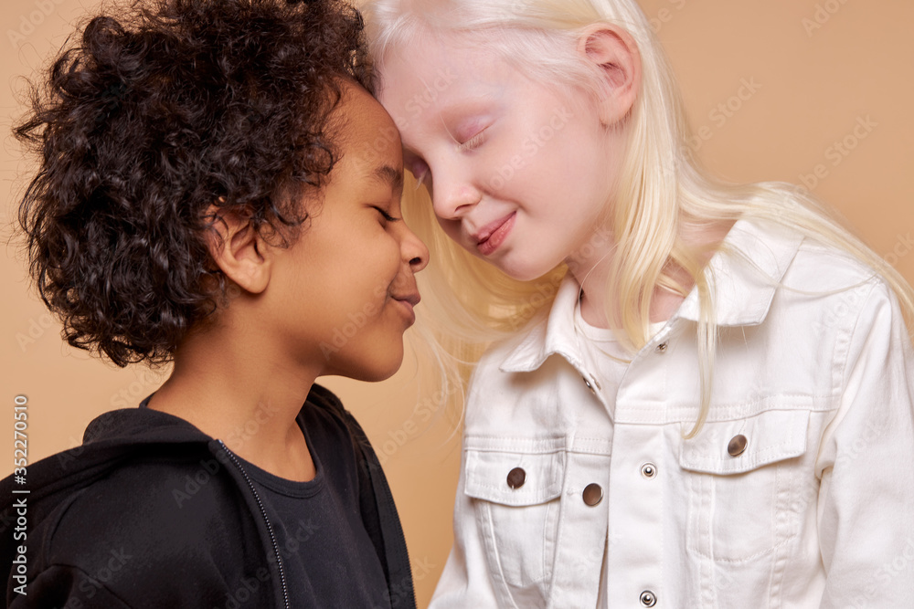 diverse black and albino kids in love, they have tender feeling for each other, people with unusual hair and skin color - obrazy, fototapety, plakaty 