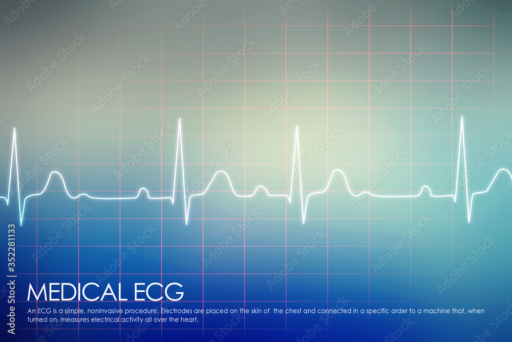 Heart with cardiogram -2D illustration
Heart with cardiogram -2D illustration