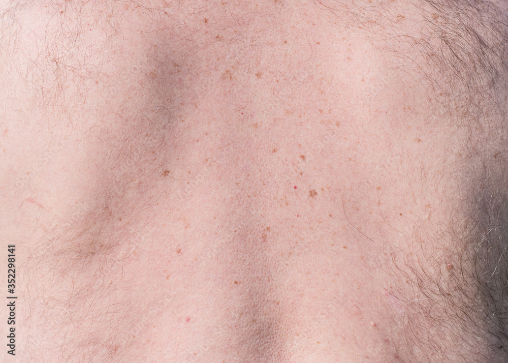 Close up detail of the bare skin on a man back with scattered moles and freckles Close up detail of the bare skin on a man back with scattered moles and freckles