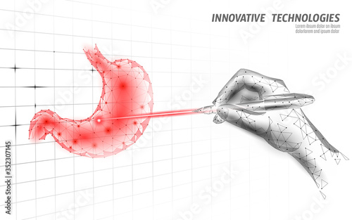 Human stomach laser surgery operation low poly. Medicine disease drug treatment painful area. Red triangles polygonal 3D render shape. Pharmacy business poster template vector illustration