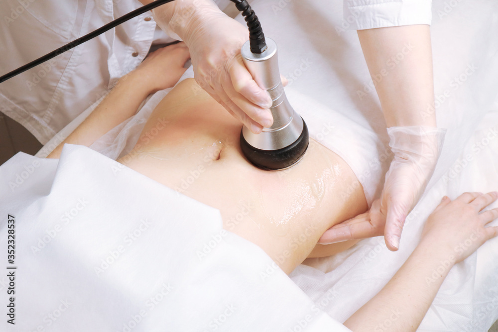 The cavitation procedure closeup. Beautician apparatus for cavitation on the woman's stomach. The concept of skin care face and body - obrazy, fototapety, plakaty 