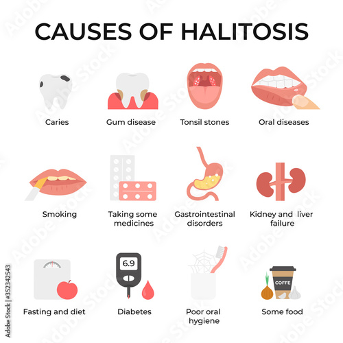 Set icons causes of halitosis, Bad breath, unpleasant breath odor. Flat vector illustration.