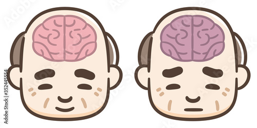 脳　シニア男性